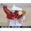 Mô hình bệnh lý hệ sinh dục nam giới